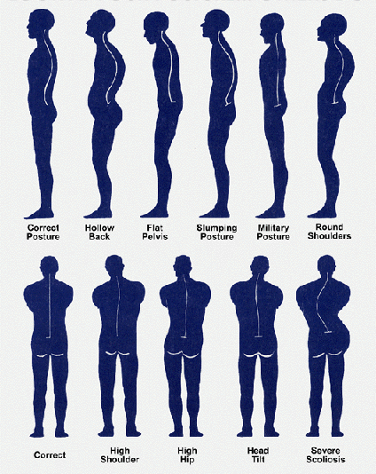 Postural Assessment ( Visual Observation )