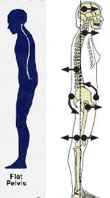 Forward Pelvic Tilt Postural Assessment Visual Observation 