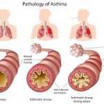 asthma-massage
