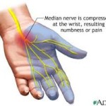 carpal-tunnel-massage