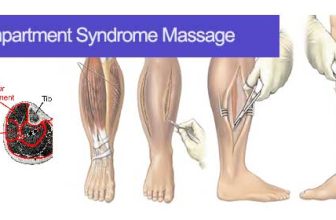 compartment syndrome massage