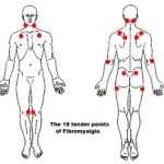 fibromyalgia massage