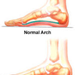 flat-feet-massage