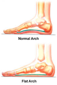 Flat Feet Massage