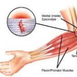 golfers elbow massage