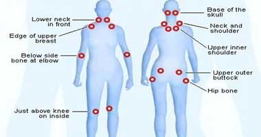 Fibromyalgia Massage Therapy Treatment