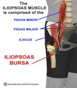 Abnormal Gait - Psoatic Limp