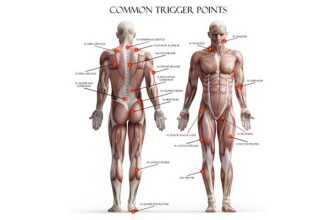 trigger points