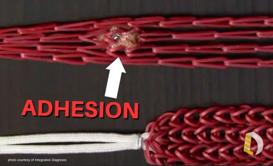 adhesion formation