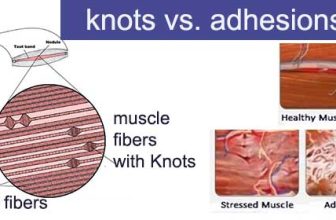 adhesion vs knots