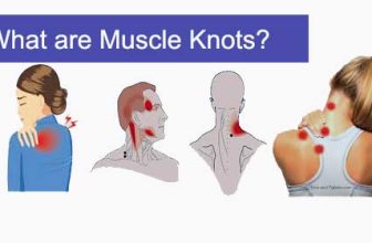 muscle knots