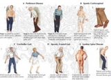 11 Abnormal Gaits – Problems With Walking (w/ Videos)