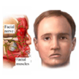 Bell’s Palsy Massage