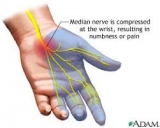 Carpal Tunnel Massage