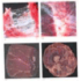 Fascia and Fascial Anatomy