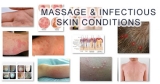 Avoid Massage with these 19 Skin Conditions! (with Pictures)