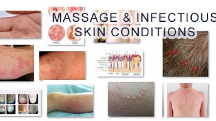 Avoid Massage with these 19 Skin Conditions! (with Pictures)