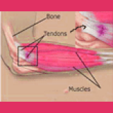 Tendonitis Massage