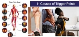 11 Causes of Trigger Points